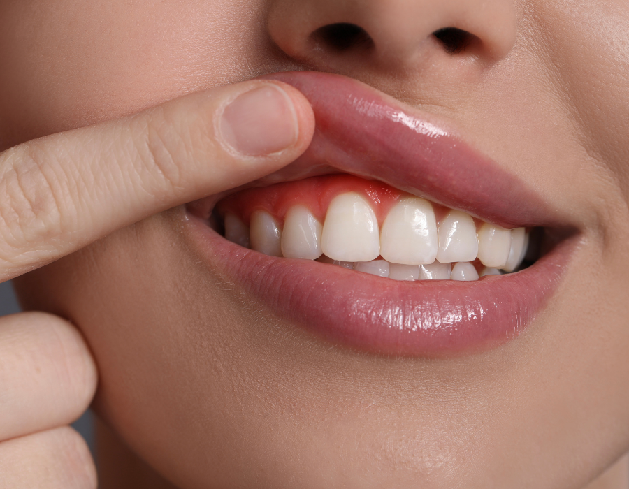 Natural Ways to Improve Gum Health